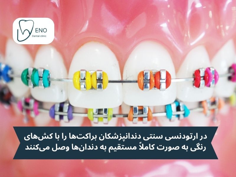ارتودنسی سنتی