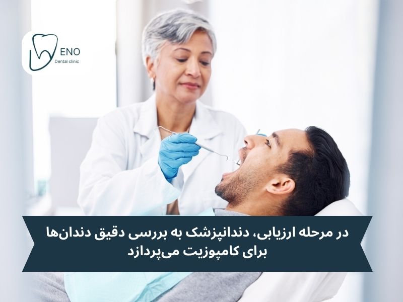 ارزیابی اولیه از اولین مراحل کامپوزیت دندان