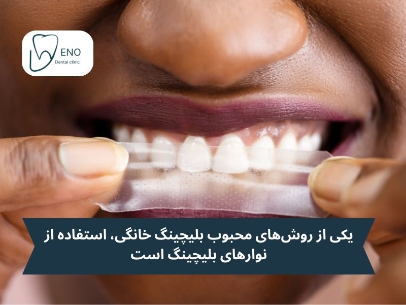 بلیچینگ خانگی؛ راهی مقرونبهصرفه و راحت برای سفید کردن دندانها