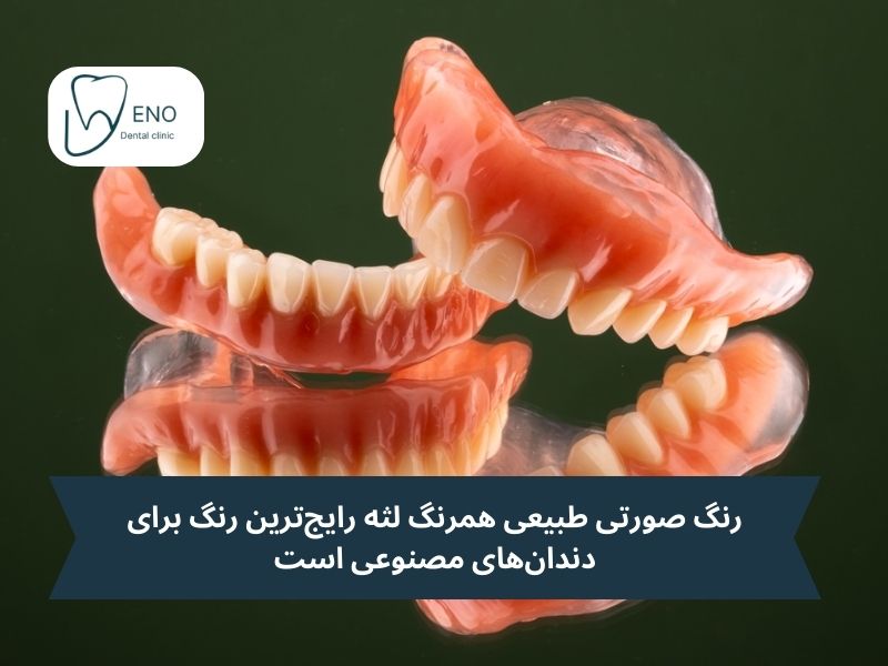 بهترین رنگ دندان مصنوعی