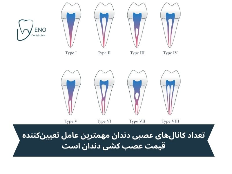 تعداد کانالهای دندان