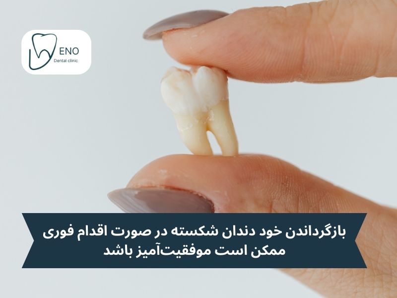 حفظ دندان شکسته برای بازگرداندن آن به جایگاه اصلی؛ عجیب اما موثر