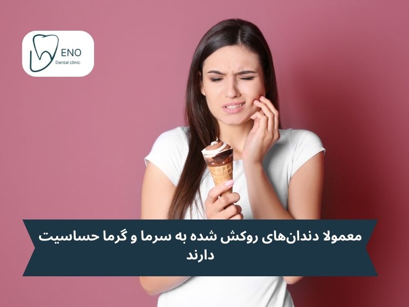 شایعترین عوارض در روکش دندان