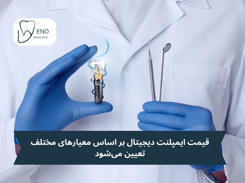 عوامل مؤثر بر قیمت نهایی ایمپلنت دیجیتال
