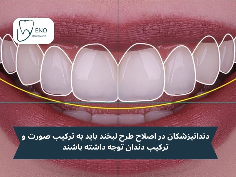 عوامل موفقیت اصلاح طرح لبخند
