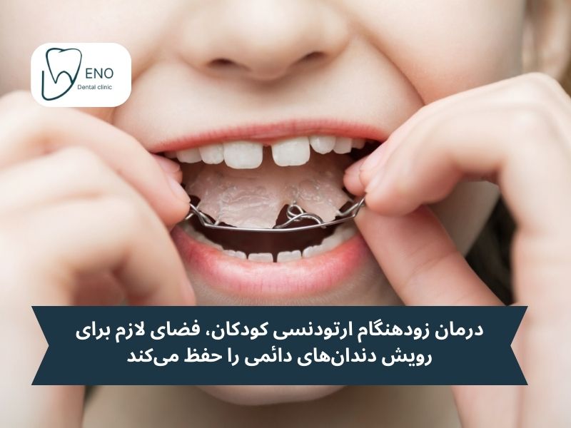 فواید ارتودنسی اطفال