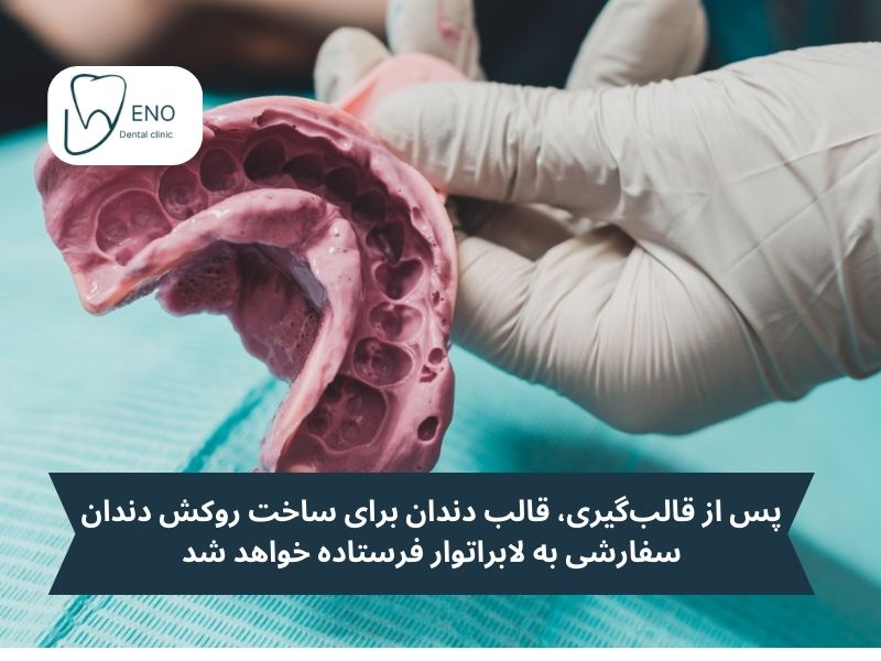 قالب گیری دندان