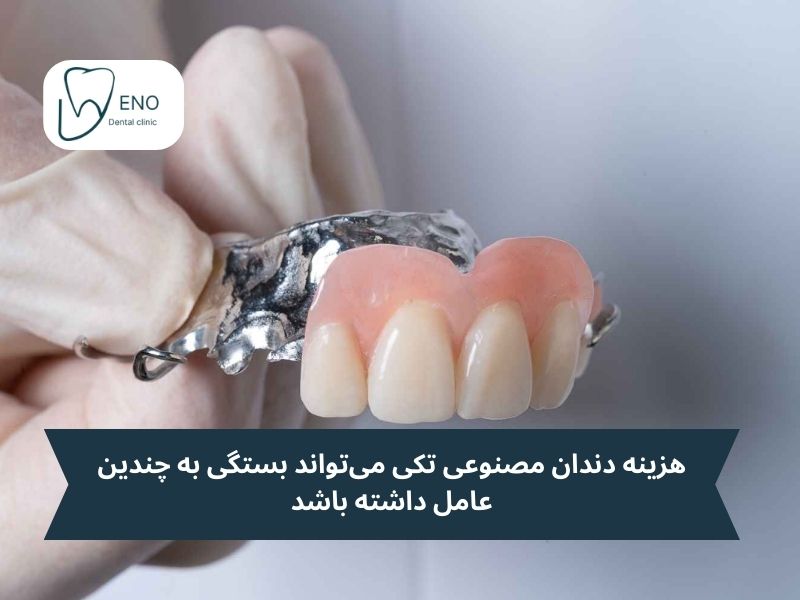 قیمت دندان مصنوعی تکی جلو