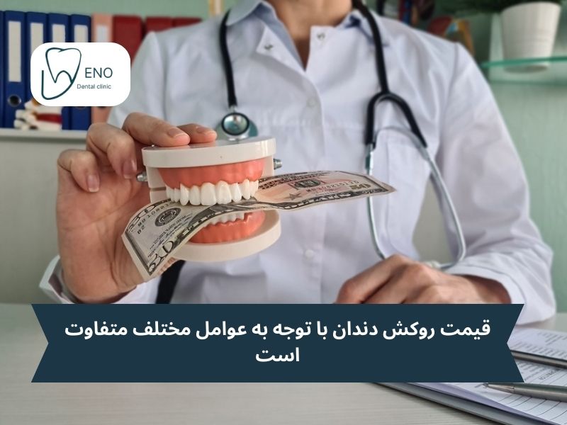 قیمت روکش دندان