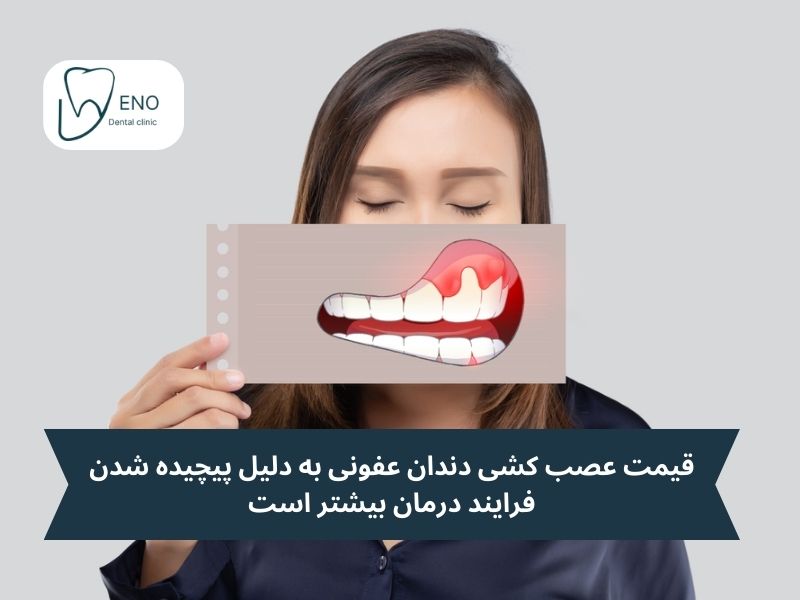 قیمت عصب کشی دندان عفونی