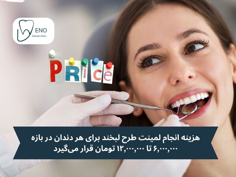 قیمت لمینت دندان طرح لبخند چقدر است؟
