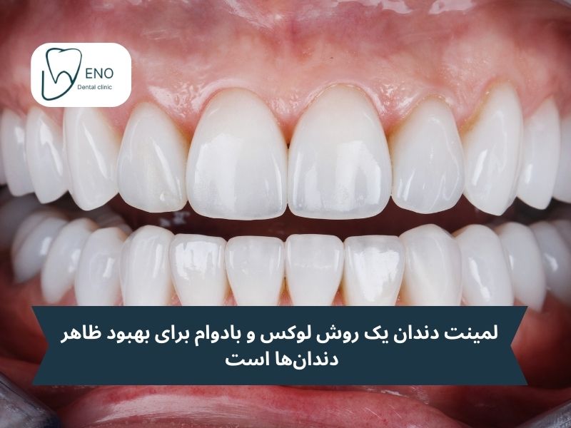 لمینت دندان؛ زیبایی جاودان با پوشش پرسلنی