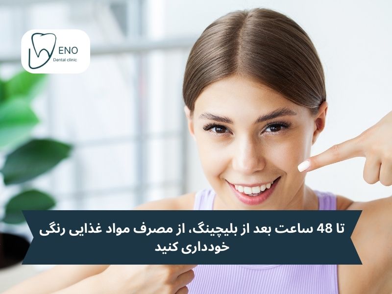 مراقبتهای بعد از بلیچینگ دندان؛ چگونه از نتایج بلیچینگ محافظت کنیم؟