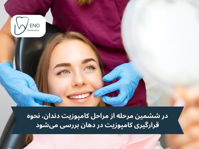 مرحله صیقلدهی و بررسی وضعیت دندان از مراحل کامپوزیت دندان