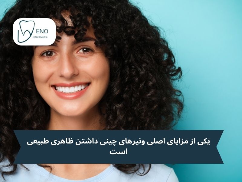 مزایای روکشهای سرامیکی