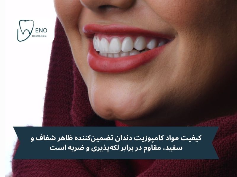 مواد تشکیل دهنده کامپوزیت دندان چیست