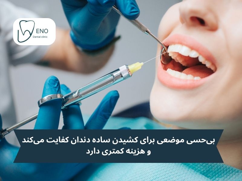 نوع بیحسی و تاثیرش بر هزینه کشیدن دندان