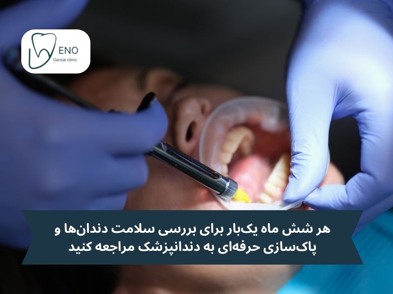 نکات مهم برای مراقبت از لمینت و کامپوزیت