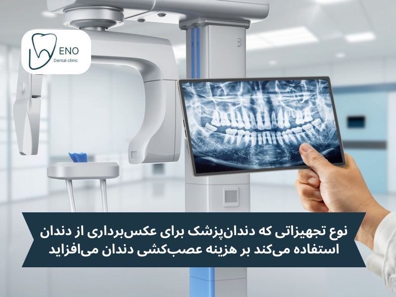 هزینه قبل از انجام عصب کشی دندان