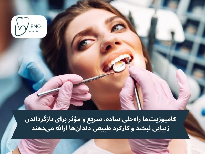 چرا ترمیم کامپوزیت دندان اهمیت دارد؟