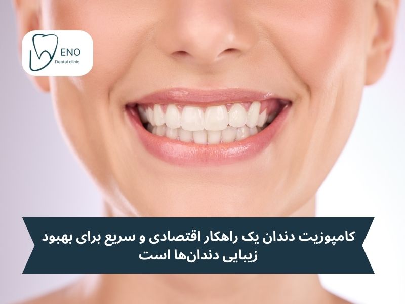 کامپوزیت دندان؛ راهی سریعتر و ارزانتر برای زیبایی