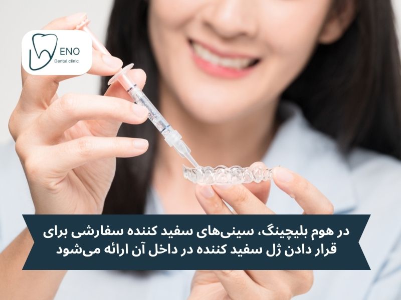 کیتهای سفید کننده خانگی
