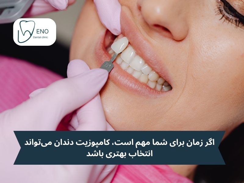 یکی دیگر از جنبههای مهم در فرق لمینت و کامپوزیت دندان، مراحل درمان و زمانی