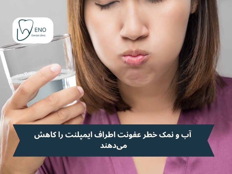 نکات مهم درباره استفاده از آب نمک بعد از ایمپلنت؛ فواید استفاده از آب نمک بعد از ایمپلنت