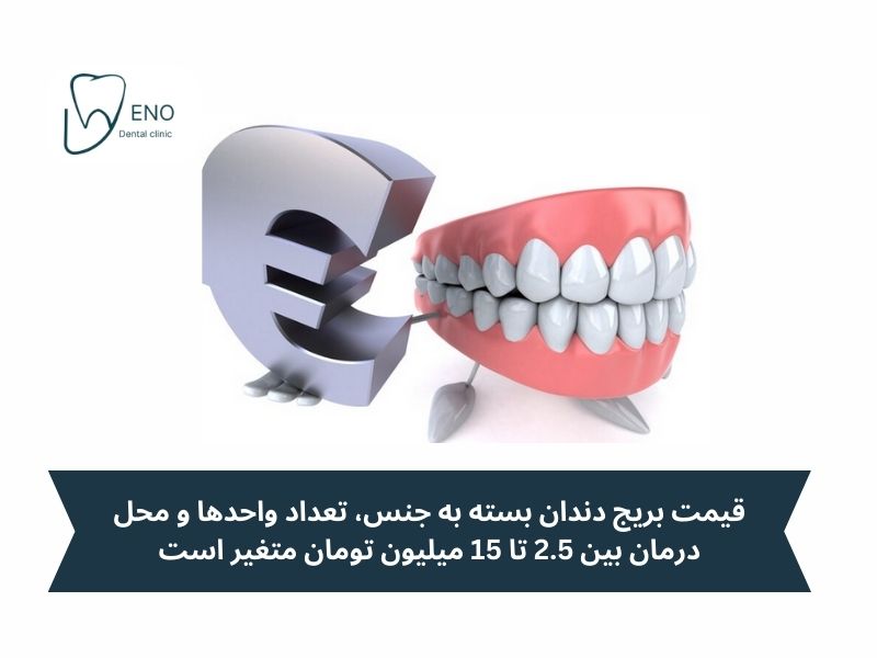 آیا بریج دندان ارزش هزینه را دارد؟