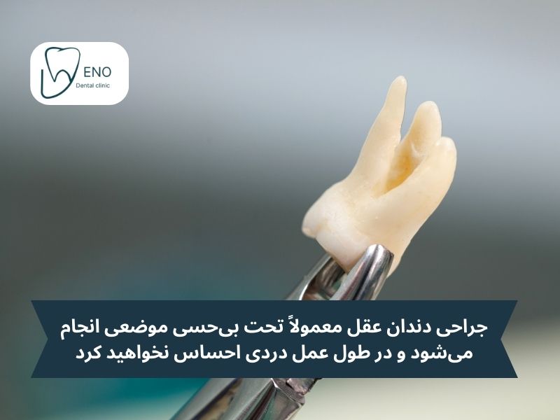 آیا جراحی دندان عقل درد دارد؟