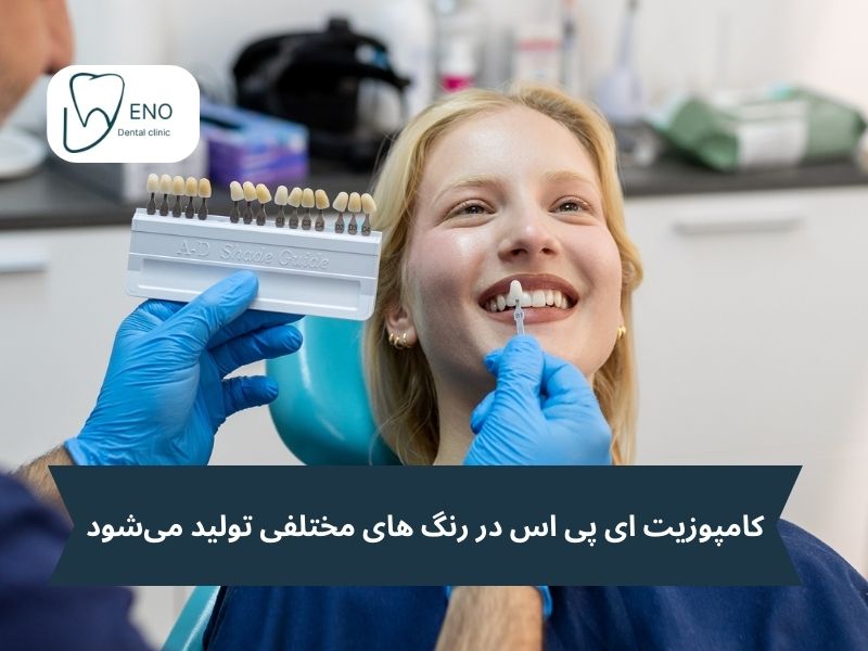 انواع رنگ های کامپوزیت ای پی اس