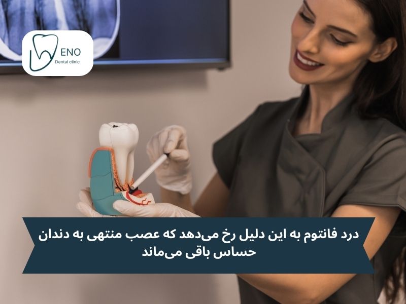 درد فانتوم