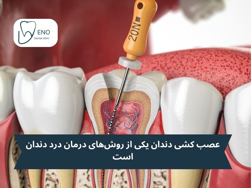 روشهای پزشکی برای درمان درد دندان؛ از داروها تا درمانهای تخصصی