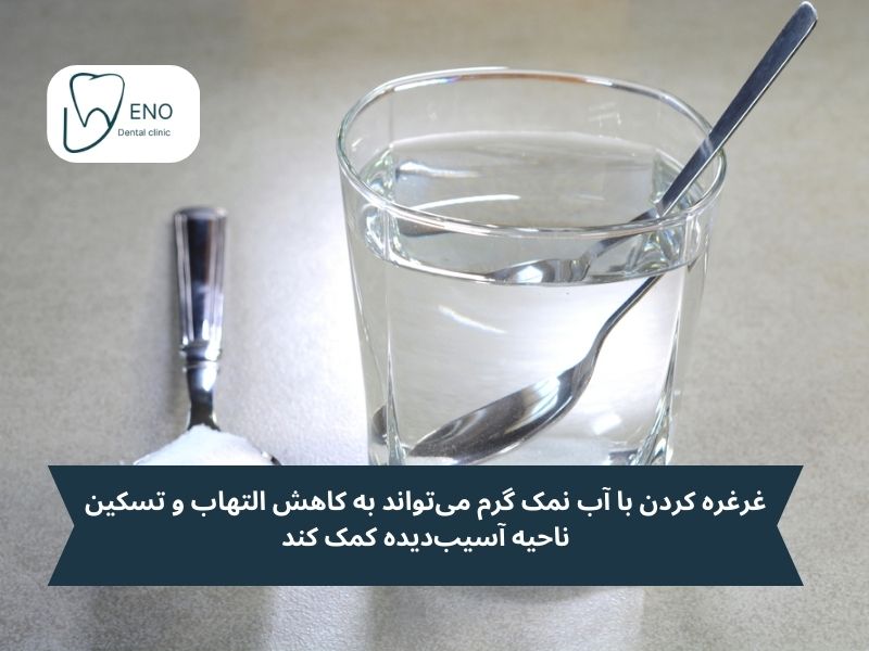 درمان درد ریشه دندان در خانه؛ 7 راهکار خانگی برای تسکین فوری درد ریشه دندان