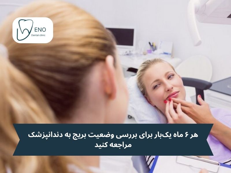 راهکارهای افزایش ماندگاری؛ چگونه از بریج دندان مراقبت کنیم