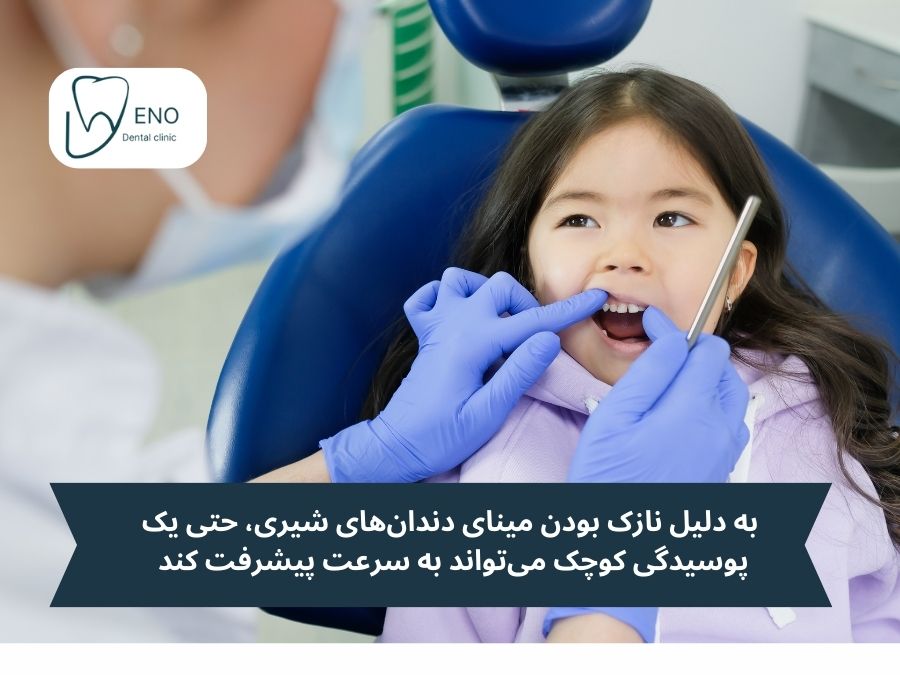 ساختار و ویژگیهای دندانهای شیری