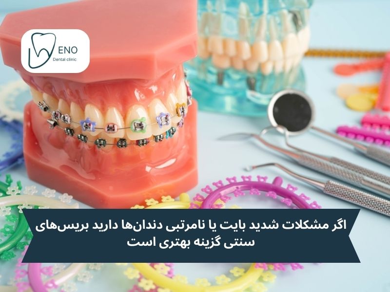 شرایط استفاده از بریس نامرئی