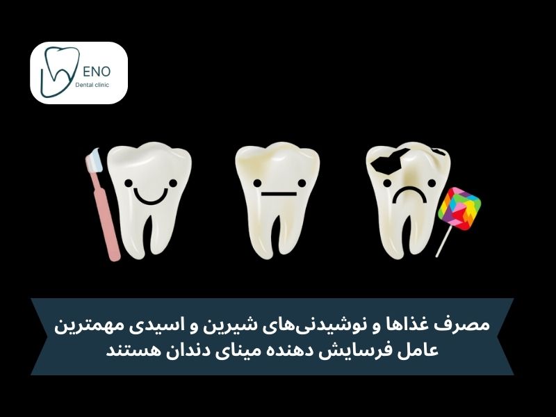 عامل فرسایش دهنده مینای دندان