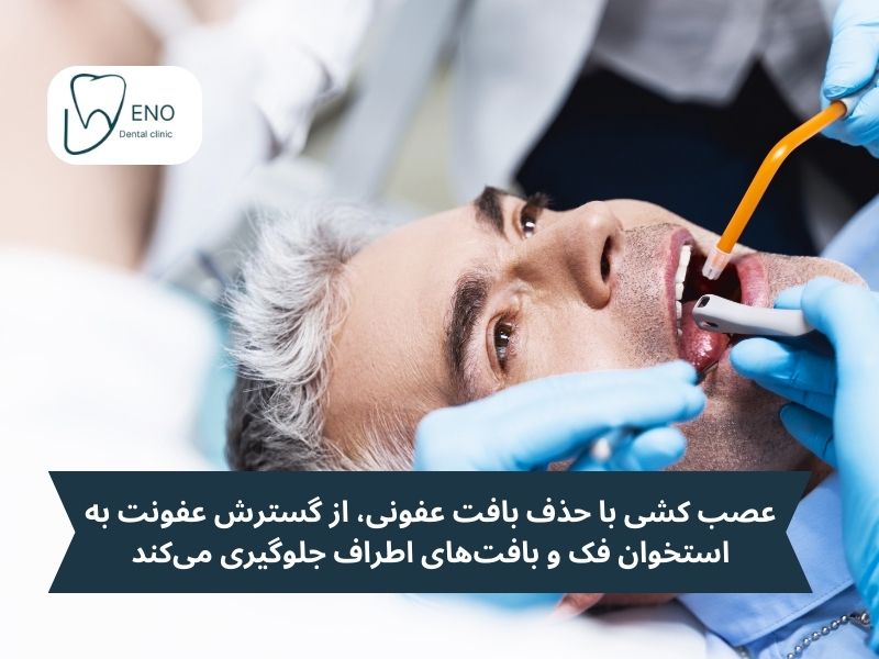 عصب کشی دندان چیست و چرا انجام میشود؟