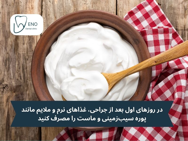 غذاها و نوشیدنیهای مناسب؛ پس از جراحی دندان عقل چی بخوریم؟