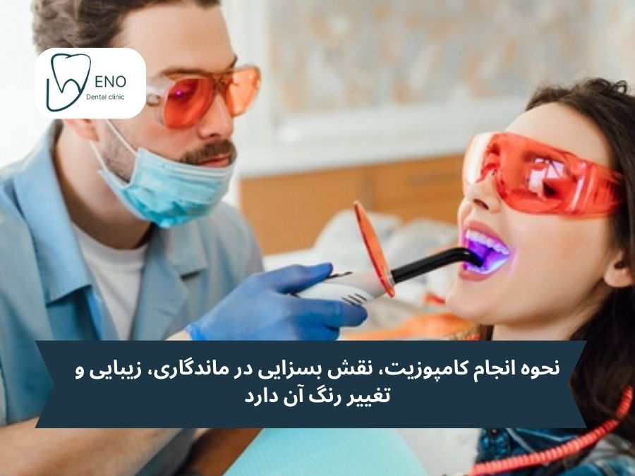 نحوه انجام کامپوزیت؛ نقش هنر و علم در کنار هم