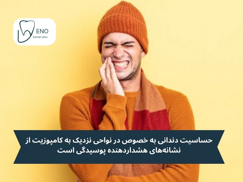 نشانههای هشداردهنده پوسیدگی در اطراف کامپوزیت