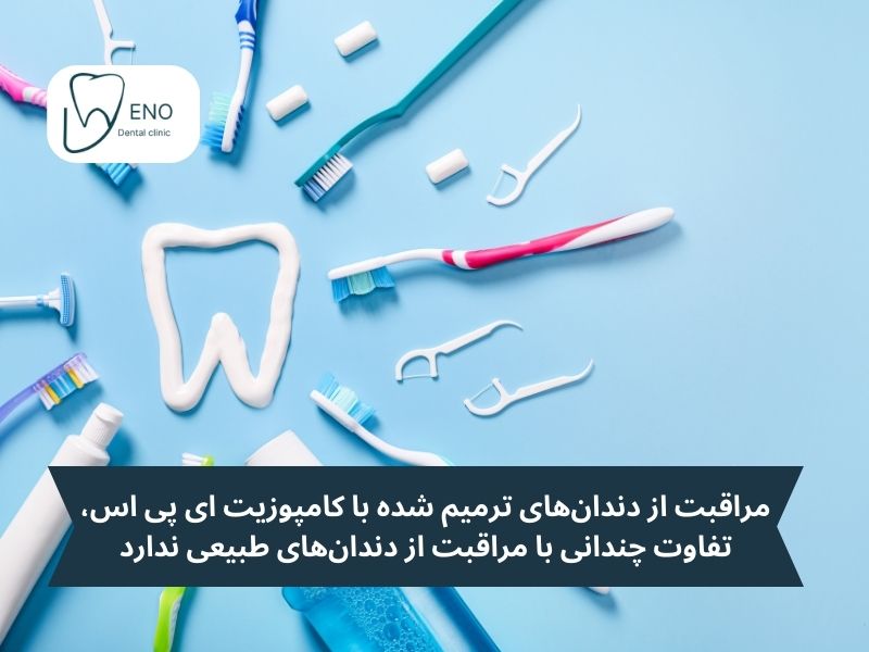نکات مهم در مورد کامپوزیت ای پی اس