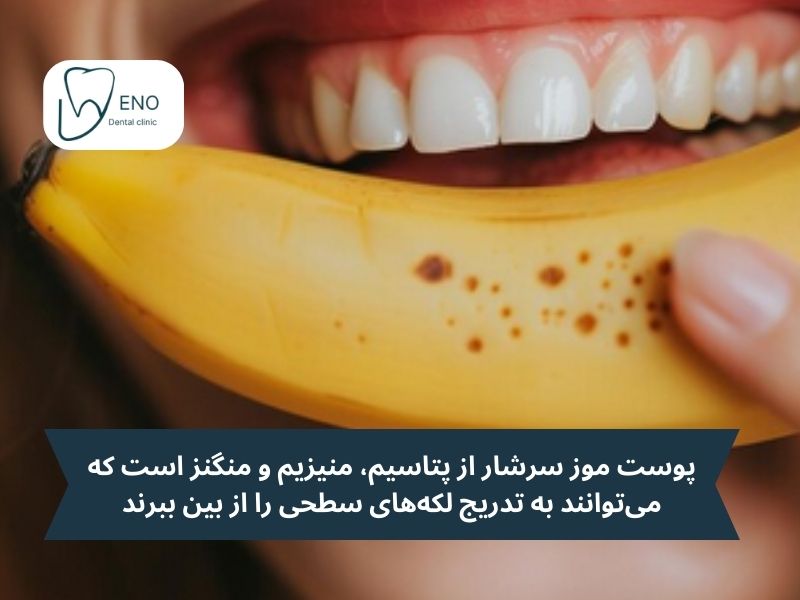 پوست موز؛ روش طبیعی و مؤثر برای سفید کردن دندانها