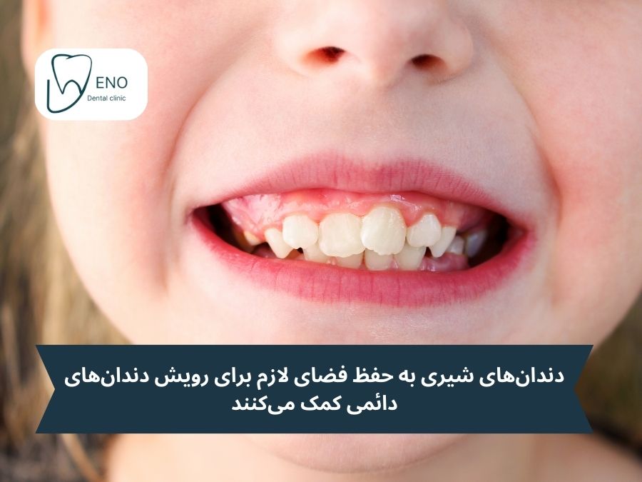 چرا باید از دندان های شیری مراقبت کنیم و چرا پوسیدگی دندانهای شیری خطرناک است