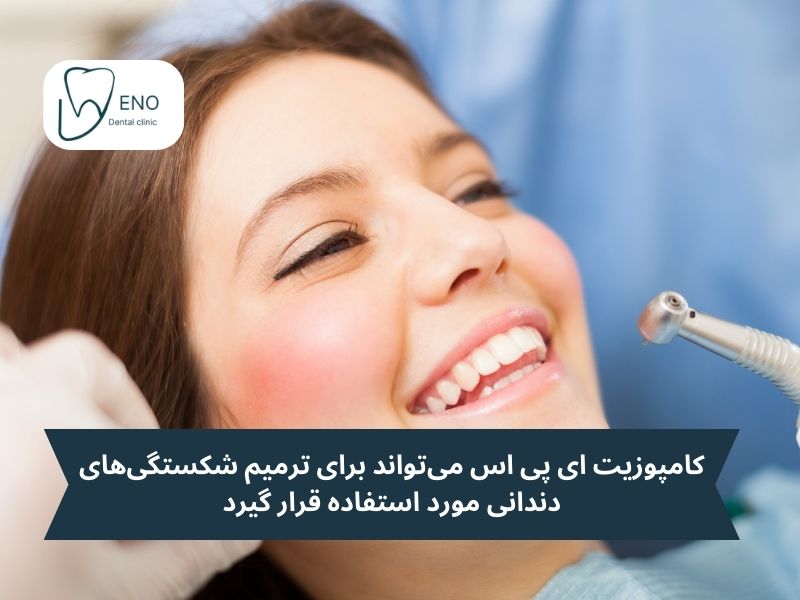 کاربردهای کامپوزیت ای پی اس در دندانپزشکی