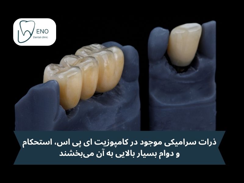 کامپوزیت ای پی اس چیست و چه ویژگیهایی دارد؟