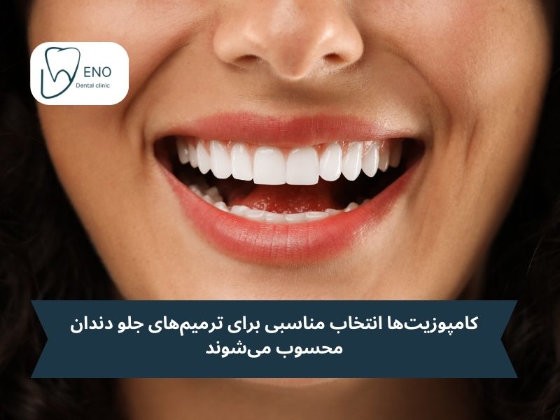 کامپوزیت دندان چیست؟