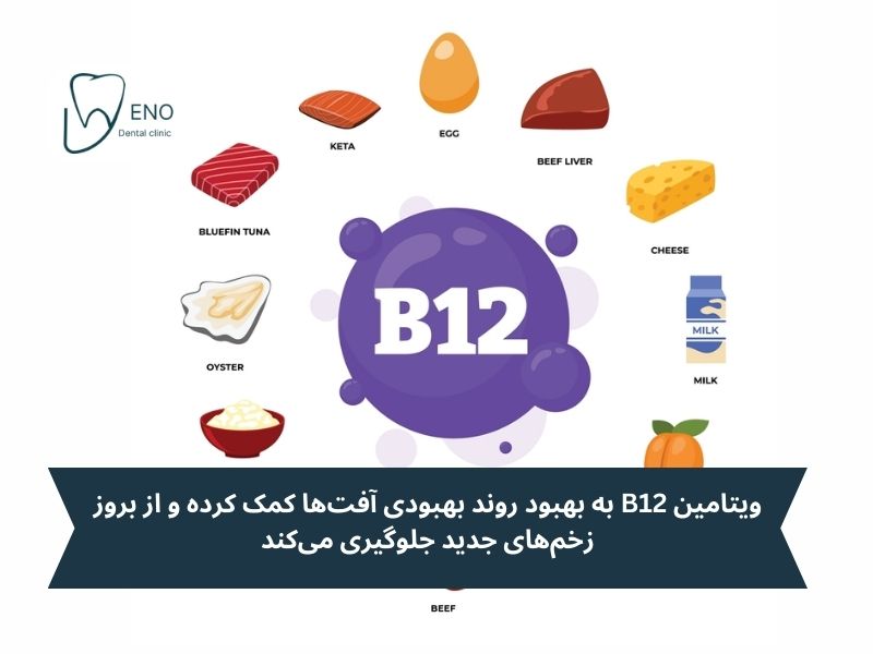 کلید درمان آفت دهان