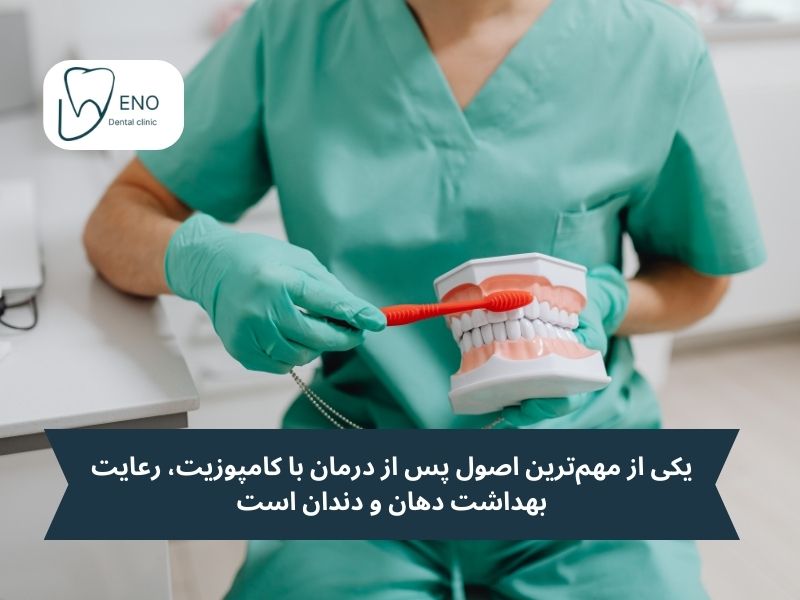 یکی از مهمترین اصول پس از درمان با کامپوزیت، رعایت بهداشت دهان و دندان است.
